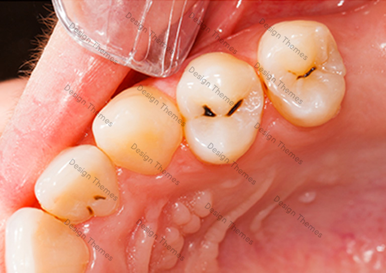Before-Dental-1